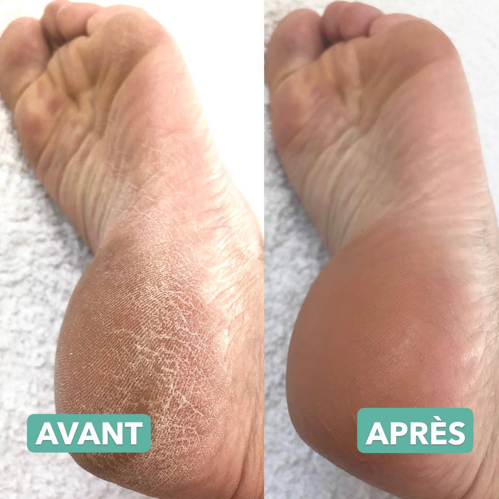 Pieds Doux & Lisses en Quelques Minutes